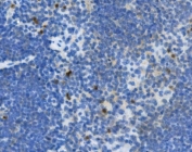 IHC staining of FFPE mouse spleen with Interleukin 10 antibody. HIER: boil tissue sections in pH8 EDTA for 20 min and allow to cool before testing.