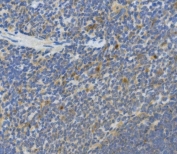 IHC staining of FFPE rat spleen with Interleukin 10 antibody. HIER: boil tissue sections in pH8 EDTA for 20 min and allow to cool before testing.