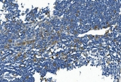 IHC staining of FFPE human appendicitis tissue with IL2RB antibody. HIER: boil tissue sections in pH8 EDTA for 20 min and allow to cool before testing.