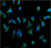 Immunofluorescent staining of FFPE human A549 cells with IL2RB antibody (green) and DAPI nuclear stain (blue). HIER: steam section in pH6 citrate buffer for 20 min.