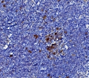 IHC staining of FFPE mouse spleen with Il-21 antibody. HIER: boil tissue sections in pH8 EDTA for 20 min and allow to cool before testing.
