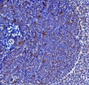IHC staining of FFPE rat spleen with Il-21 antibody. HIER: boil tissue sections in pH8 EDTA for 20 min and allow to cool before testing.