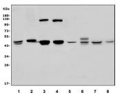 Western blot testing of human 1) Caco-2, 2) SH-SY5Y, 3) HEK293, 4) K562, 5) A549, 6) rat RH35, 7) mouse kidney and 8) mouse HEPA1-6 lysate with KCNJ8 antibody. Predicted molecular weight ~48 kDa.