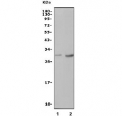 Western blot testing of 1) rat blood and 2) mouse thymus lysate with Cd94 antibody. Expected molecular weight: 19-30 kDa depending on glycosylation level.