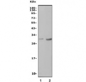 Western blot testing of 1) rat blood and 2) mouse thymus lysate with Cd94 antibody. Expected molecular weight: 19-30 kDa depending on glycosylation level.