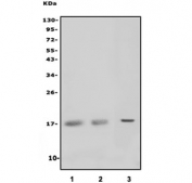 Western blot testing of human 1) Jurkat, 2) Raji and 3) HL60 cell lysate with MAL antibody. Predicted molecular weight ~17 kDa.