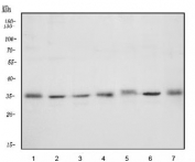 Western blot testing of human 1) HeLa, 2) Jurkat, 3) HEK293, 4) A549, 5) MCF7, 6) PC-3 and 7) T-47D cell lysate with METTL1 antibody. Predicted molecular weight ~34 kDa.