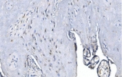 IHC staining of FFPE human placenta with METTL3 antibody. HIER: boil tissue sections in pH8 EDTA for 20 min and allow to cool before testing.