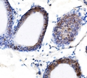 IHC staining of FFPE rat epididymis with METTL3 antibody. HIER: boil tissue sections in pH8 EDTA for 20 min and allow to cool before testing.