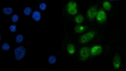 Immunofluorescent staining of FFPE human PC-3 cells with METTL3 antibody (green) and DAPI nuclear stain (blue). HIER: steam section in pH6 citrate buffer for 20 min.