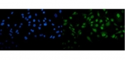 Immunofluorescent staining of FFPE human PC-3 cells with METTL3 antibody (green) and DAPI nuclear stain (blue). HIER: steam section in pH6 citrate buffer for 20 min.