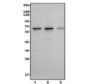 Western blot testing of human 1) A549, 2) Raji and 3) A431 cell lysate with METTL14 antibody. Expected molecular weight: 52-65 kDa.