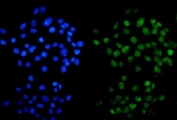 Immunofluorescent staining of FFPE human A431 cells with METTL14 antibody (green) and DAPI nuclear stain (blue). HIER: steam section in pH6 citrate buffer for 20 min.