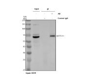 Immunoprecipitation of METTL14 protein from 500ug of human A549 whole cell lysate with 2ug of METTL14 antibody.