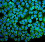 Immunofluorescent staining of FFPE human MCF7 cells with NDUFB10 antibody (green) and DAPI nuclear stain (blue). HIER: steam section in pH6 citrate buffer for 20 min.