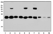 Western blot testing of human 1) HeLa, 2) HepG2, 3) Jurkat, 4) HEK293, 5) MCF7, 6) PC-3, 7) A549, 8) HL60, 9) rat liver and 10) mouse liver lysate with NDUFB10 antibody. Predicted molecular weight ~22 kDa.