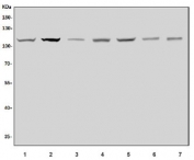 Western blot testing of 1) human HeLa, 2) human U-87 MG, 3) rat spleen, 4) rat PC-12, 5) mouse thymus, 6) mouse lung and 7) mouse spleen lysate with NALP3 antibody. Predicted molecular weight ~118 kDa.