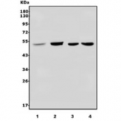 Western blot testing of 1) human PC-3, 2) human HL60, 3) mouse liver and 4) mouse RAW264.7 lysate with LXR beta antibody. Predicted molecular weight ~51 kDa.