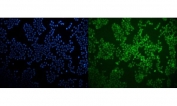Immunofluorescent staining of FFPE human MCF7 cells with LXR beta antibody (green) and DAPI nuclear stain (blue). HIER: steam section in pH6 citrate buffer for 20 min.