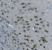 IHC staining of FFPE mouse brain with PCBP2 antibody. HIER: boil tissue sections in pH8 EDTA for 20 min and allow to cool before testing.