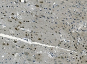 IHC staining of FFPE rat brain with PCBP2 antibody. HIER: boil tissue sections in pH8 EDTA for 20 min and allow to cool before testing.