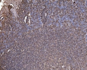 IHC staining of FFPE human tonsil with RAB1B antibody. HIER: boil tissue sections in pH8 EDTA for 20 min and allow to cool before testing.