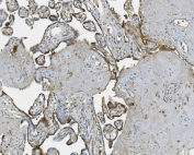 IHC staining of FFPE human placenta with RAB1B antibody. HIER: boil tissue sections in pH8 EDTA for 20 min and allow to cool before testing.