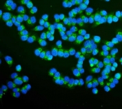 Immunofluorescent staining of FFPE human T-47D cells with RAB1B antibody (green) and DAPI nuclear stain (blue). HIER: steam section in pH6 citrate buffer for 20 min.