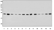 Western blot testing of human 1) HeLa, 2) HEK293, 3) SK-OV-3, 4) MCF7, 5) A375, 6) U-87 MG, 7) A549, 8) rat kidney, 9) rat brain, 10) rat heart, 11) rat NRK, 12) mouse brain and 13) mouse heart lysate with RAB1B antibody. Predicted molecular weight ~24 kDa.