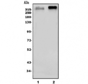 Western blot testing of 1) rat brain and 2) mouse brain lysate with Scn2a antibody. Predicted molecular weight ~320 kDa.