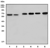 Western blot testing of 1) human Daudi, 2) human HL60, 3) rat brain, 4) rat testis, 5) mouse brain and 6) mouse testis lysate with STK39 antibody. Predicted molecular weight ~60 kDa.