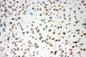 IHC staining of FFPE mouse brain with SUMO1 antibody. HIER: boil tissue sections in pH8 EDTA for 20 min and allow to cool before testing.
