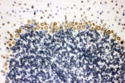 IHC staining of FFPE mouse brain with SUMO1 antibody. HIER: boil tissue sections in pH8 EDTA for 20 min and allow to cool before testing.