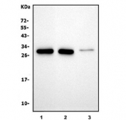 Western blot testing of 1) rat spleen, 2) rat plasma and 3) mouse spleen lysate with Tigit antibody. Predicted molecular weight ~26 kDa.