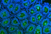 Immunofluorescent staining of FFPE rat stomach tissue with Tspan1 antibody (green) and DAPI nuclear stain (blue). HIER: steam section in pH6 citrate buffer for 20 min.