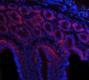 Immunofluorescent staining of FFPE rat intestinal tissue with Tspan8 antibody (red) and DAPI nuclear stain (blue). HIER: steam section in pH6 citrate buffer for 20 min.