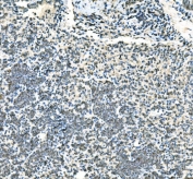 IHC staining of FFPE mouse lung lymph node tissue with UBE2D1/2/3/4 antibody. HIER: boil tissue sections in pH8 EDTA for 20 min and allow to cool before testing.