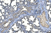 IHC staining of FFPE rat lung tissue with UBE2D1/2/3/4 antibody. HIER: boil tissue sections in pH8 EDTA for 20 min and allow to cool before testing.