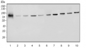 Western blot testing of human 1) placenta, 2) U937, 3) K562, 4) HepG2, 5) HeLa, 6) Jurkat, 7) rat testis, 8) rat C6, 9) mouse testis and 10) mouse RAW264.7 lysate with YTHDC1 antibody. Predicted molecular weight ~85 kDa.