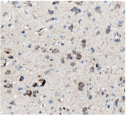 IHC staining of FFPE rat brain with CKAP5 antibody. HIER: boil tissue sections in pH8 EDTA for 20 min and allow to cool before testing.
