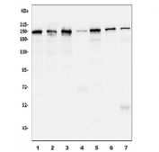 Western blot testing of human 1) U-87 MG, 2) COLO-320, 3) SW620, 4) HepG2, 5) Caco-2, 6) rat brain and 7) mouse brain lysate with CKAP5 antibody. Predicted molecular weight ~225 kDa.