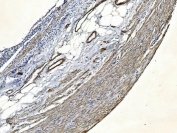 IHC staining of FFPE human appendicitis tissue with FLNA antibody. HIER: boil tissue sections in pH8 EDTA for 20 min and allow to cool before testing.