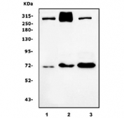 Western blot testing of human 1) A549, 2) HeLa and 3) SW620 cell lysate with FLNA antibody. Predicted molecular weight ~281 kDa.