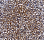 IHC staining of FFPE rat liver with CES1 antibody. HIER: boil tissue sections in pH8 EDTA for 20 min and allow to cool before testing.