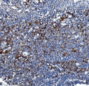 IHC staining of FFPE human tonsil with CES1 antibody. HIER: boil tissue sections in pH8 EDTA for 20 min and allow to cool before testing.