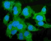 Immunofluorescent staining of FFPE human HepG2 cells with CES1 antibody (green) and DAPI nuclear stain (blue). HIER: steam section in pH6 citrate buffer for 20 min.