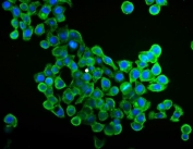 Immunofluorescent staining of FFPE human Caco-2 cells with EIF4A1 antibody (green) and DAPI nuclear stain (blue). HIER: steam section in pH6 citrate buffer for 20 min.