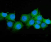 Immunofluorescent staining of FFPE human MCF7 cells with ASS1 antibody (green) and DAPI nuclear stain (blue). HIER: steam section in pH6 citrate buffer for 20 min.