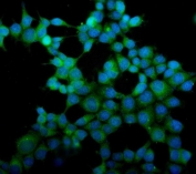 Immunofluorescent staining of FFPE human MCF7 cells with eRF1 antibody (green) and DAPI nuclear stain (blue). HIER: steam section in pH6 citrate buffer for 20 min.