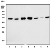 Western blot testing of human 1) HeLa, 2) Jurkat, 3) K562, 4) Raji, 5) HepG2, 6) rat PC-12 and 7) mouse RAW264.7 cell lysate with eRF1 antibody. Predicted molecular weight ~49 kDa.